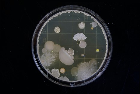 Bacteria on a petri dish.jpg
